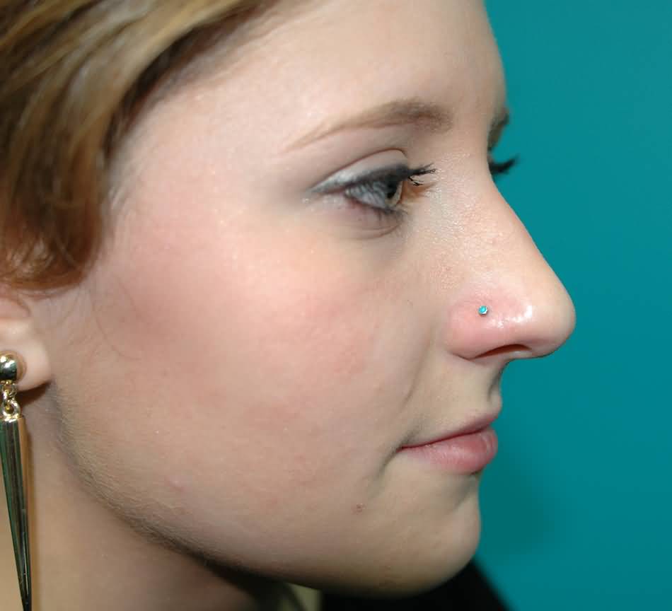 Beautiful Nostril Piercing With Blue Stud