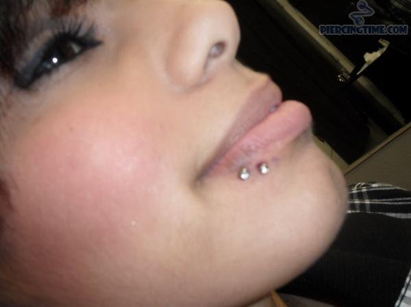 Girl Have Spider Bite Piercing With Dermal Anchors