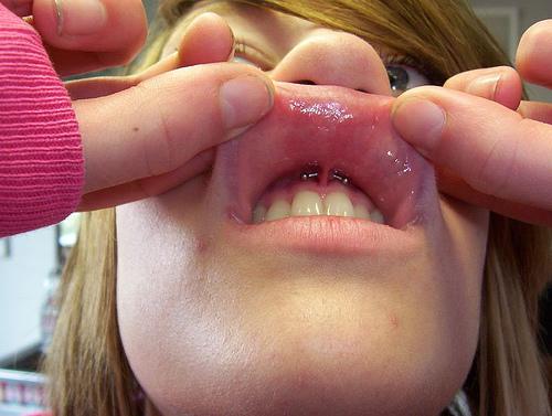 Girl Showing Her Upper Lip Frenulum Piercing