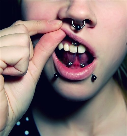 Girl With Smiley And Snake Bites Piercings