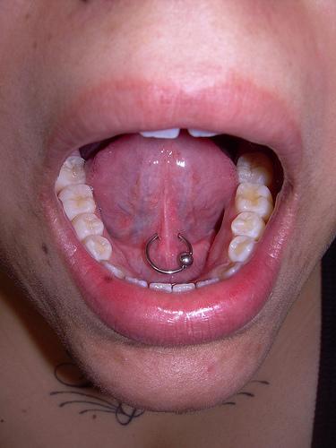 Lingual Frenulum Piercing With Silver Bead Ring