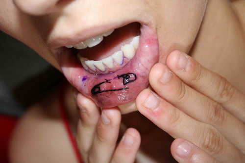 Simple Safety Pin Tattoo On Inner Lips For Girls