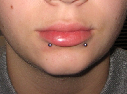 Snake Bites Piercing With Silver Studs On Lower Lip