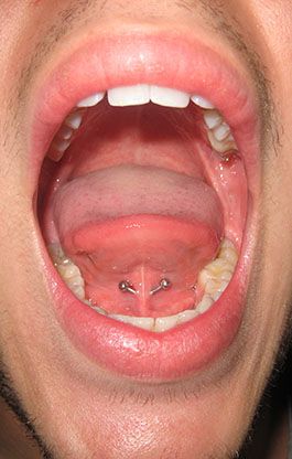 Tongue Frenulum Piercing With Curved Barbell