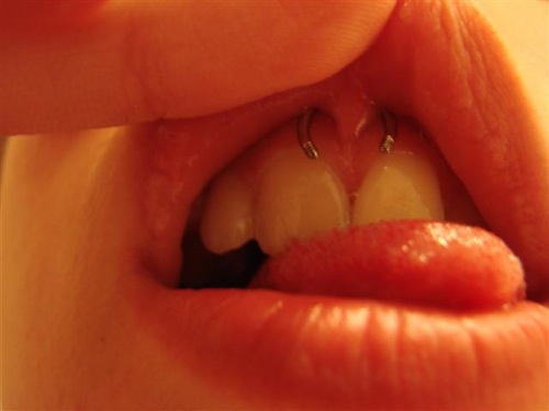 Upper Lip Frenulum Piercing Picture