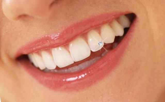 Dental Piercing With Diamond Jewel