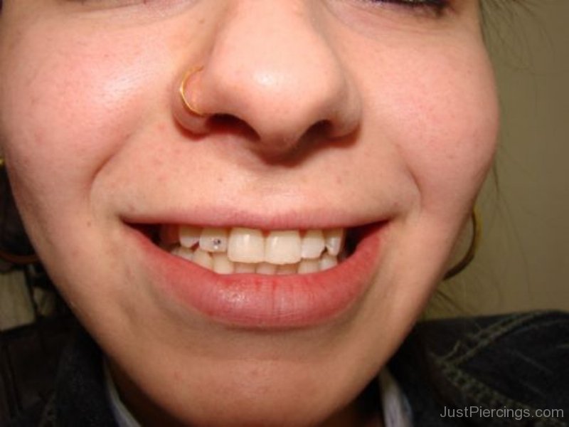 Girl With Right Nostril And Tooth Piercing