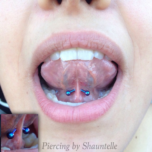 Lingual Frenulum Piercing With Blue Curved Barbell