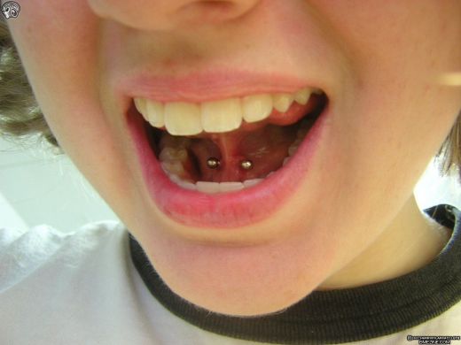 Lingual Frenulum Piercing With Small Silver Barbell
