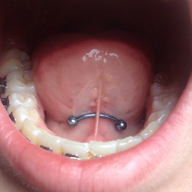 Nice Lingual Frenulum Piercing With Curved Barbell
