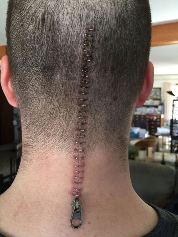 Realistic Full Close Zipper Tattoo On Back Head And Neck