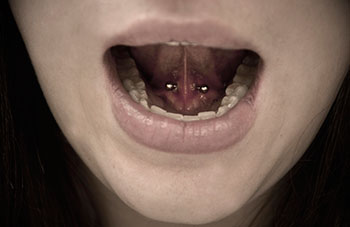 Silver Barbell Lingual Frenulum Piercing Picture