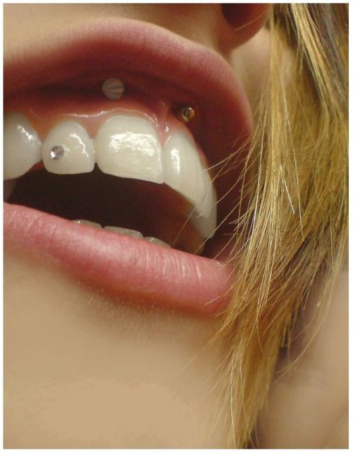 Smiley Piercing And Tooth Piercing For Girls