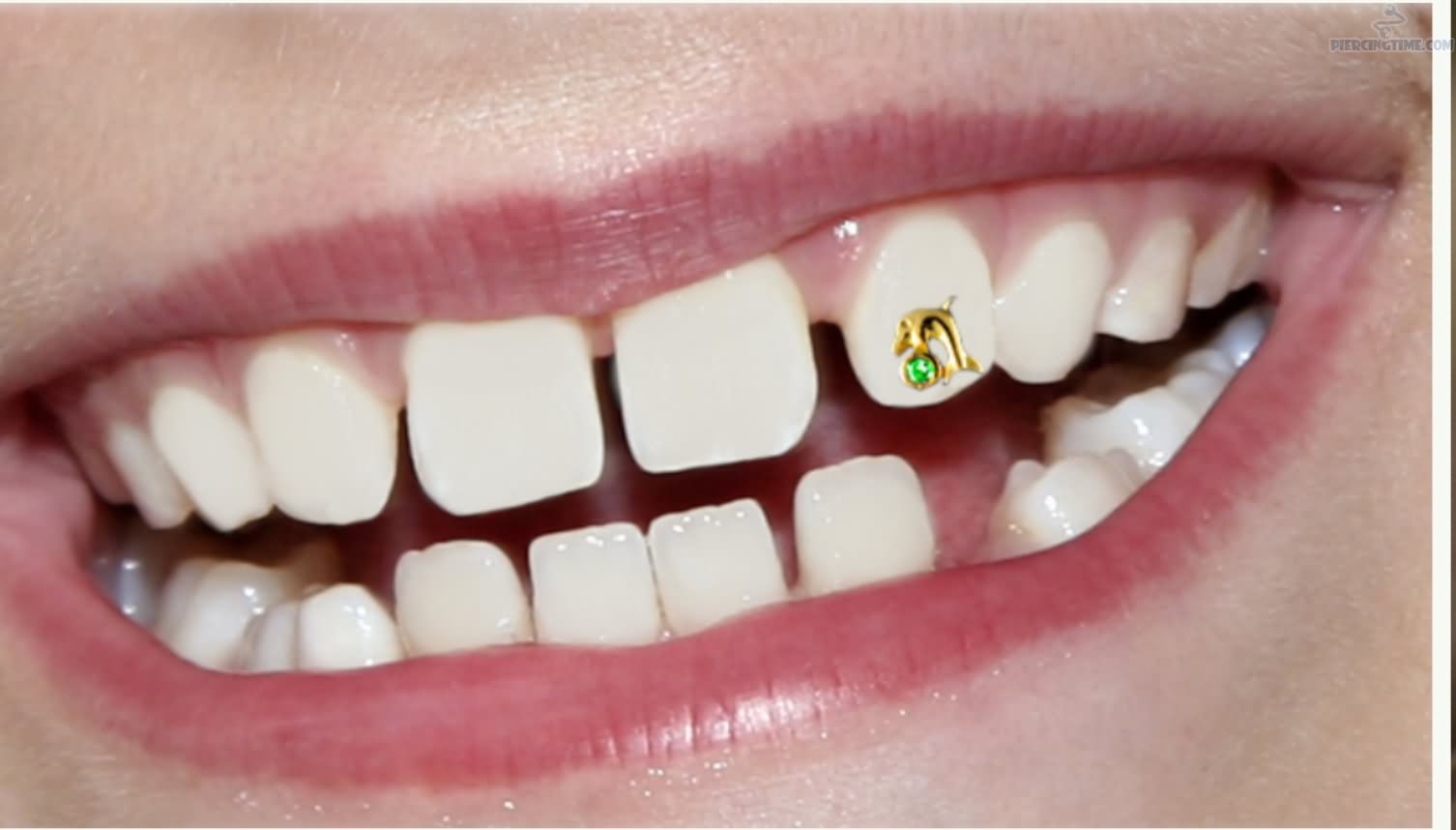 Tooth Piercing With Dolphin Gold Stud