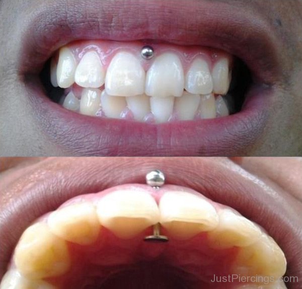 Tooth Piercing With Silver Stud