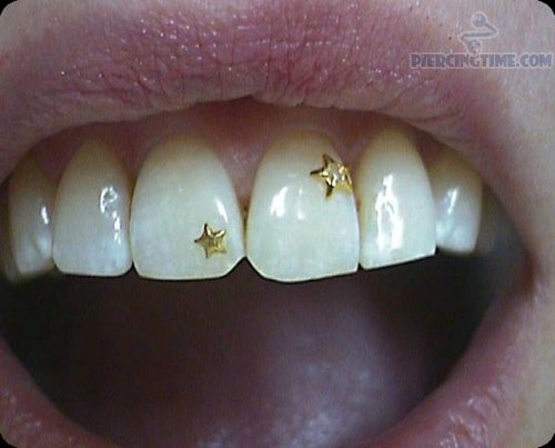 Tooth Piercing With Star Gold Jewels