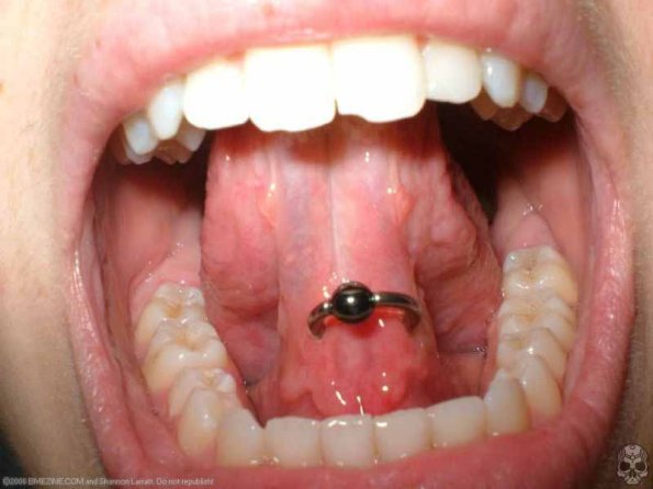 Bead Ring Tongue Web Oral Piercing