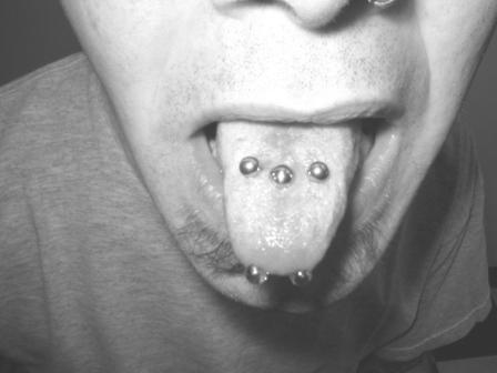 Nice Multiple Tongue Piercing With Silver Studs