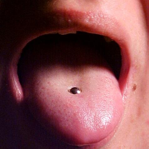 Oral Tongue Piercing With Stud