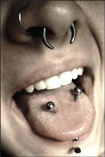 Septum And Multiple Tongue Piercing Picture For Girls