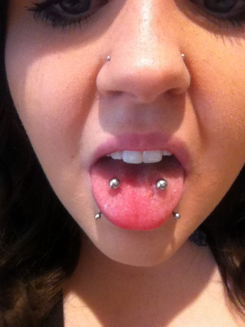 Snake Bites And Multiple Tongue Piercing