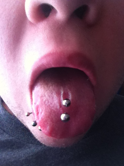 Spider Bites And Oral Tongue Piercing
