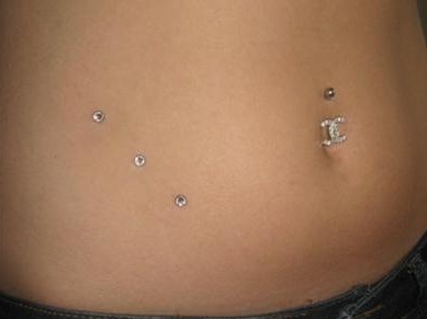 Belly Piercing And Dermal Anchoring Piercing