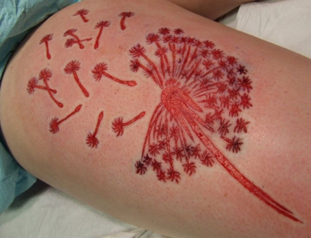 Dandelion Scarification Tattoo On Thigh