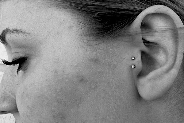 Double Tragus Piercing With Dermal Anchors