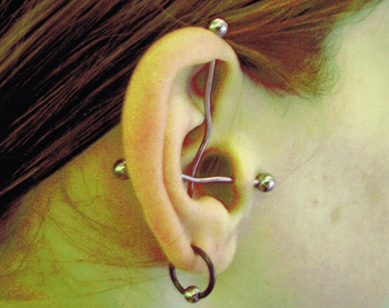 Girl With Right Ear Lobe And Ear Project Piercing