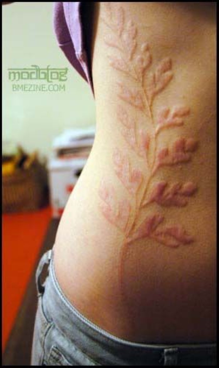 Healed Plant Scarification Tattoo