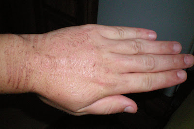 Healed UV Tattoo On Hand Under Daylight