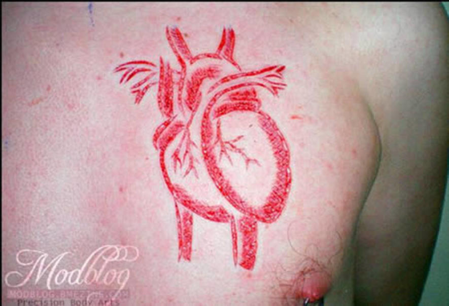 Heart Having Legs Scarification Tattoo On Chest