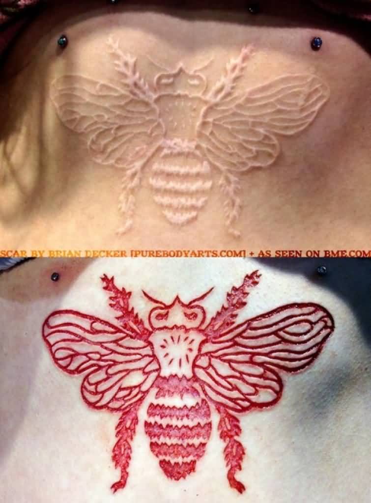 Honey Bee Scarification Before And After Tattoo