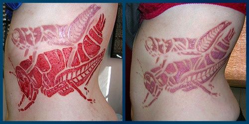 Insects Scarification Before And After Tattoo On Side Rib For Women
