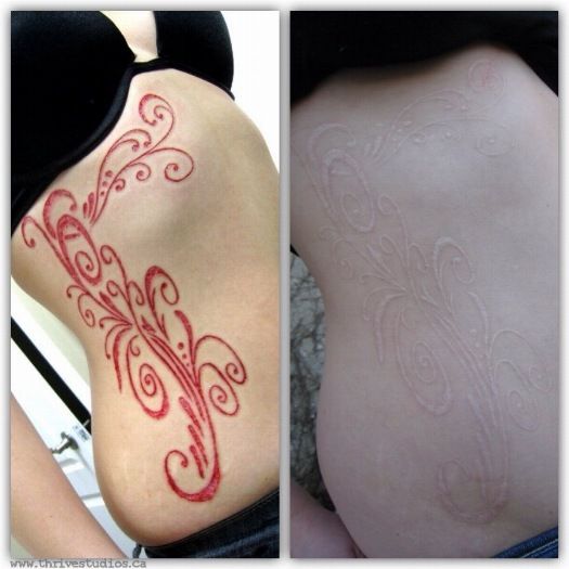 Lovely Before And After Scarification Tattoo On Side Rib For Girls