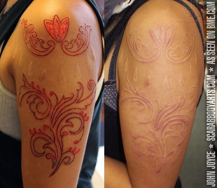 Nice Flower Design Scarification Before And After Tattoo On Left Half Sleeve