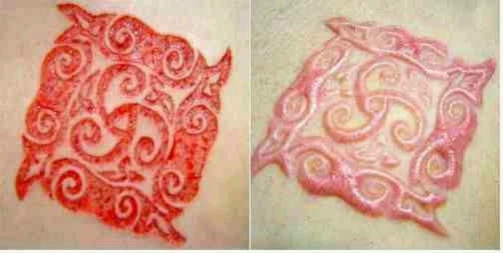 Nice Scarification Before And After Design Tattoo