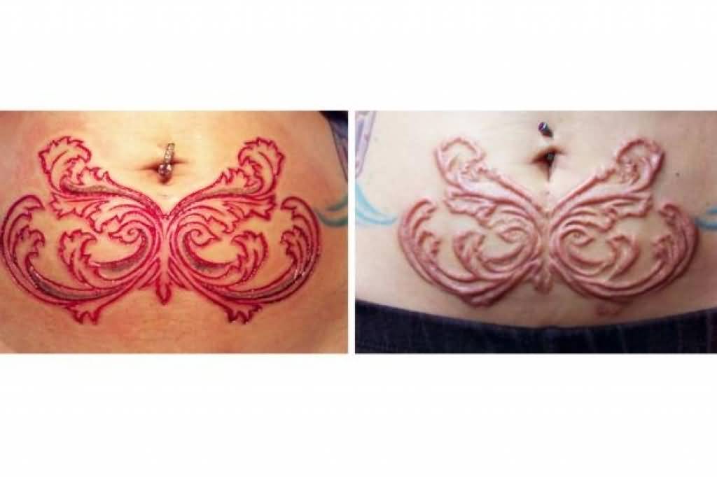 Scarification Before And After Tattoo On Bottom Of Belly