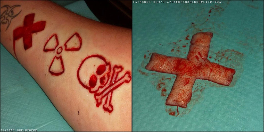 Scarification Danger Symbols Tattoo On Arm