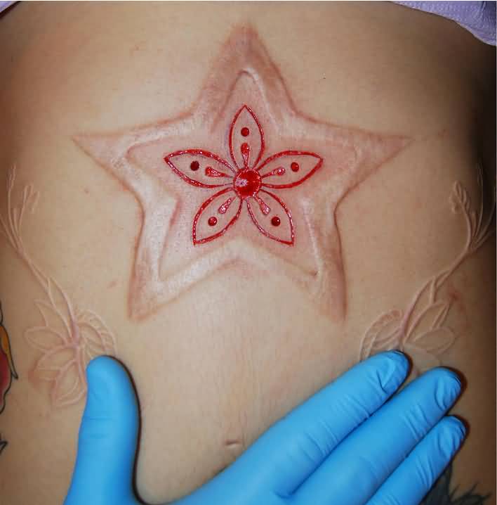 Scarification Flower Star Tattoo By Jeremy Upshaw