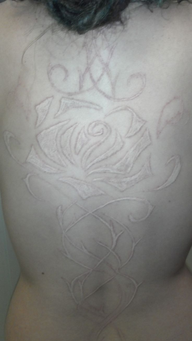 Scarification Flower Tattoo On Back