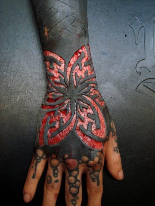Scarification Over Black Ink Tattoo On Hand