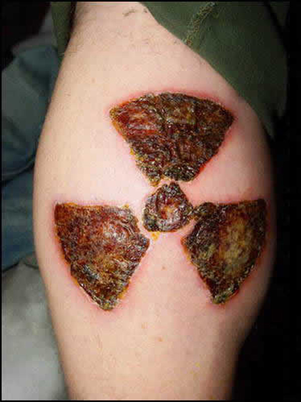 Scarification Radioactive Symbol Tattoo On Thigh