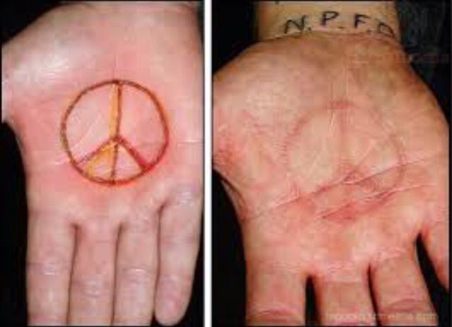 Scarification Symbol Tattoo On Palm