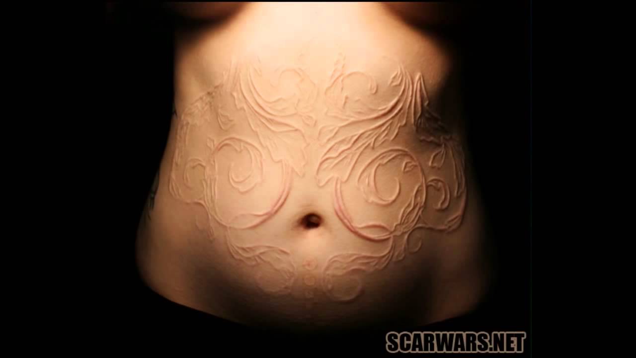 Scarification Tattoo Around Belly