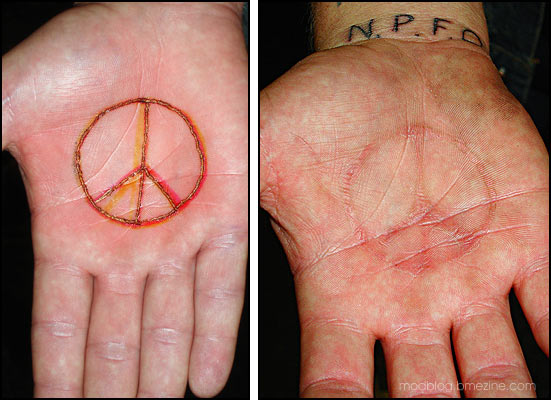 Simple Symbol Scarification Before And After Tattoo On Hand