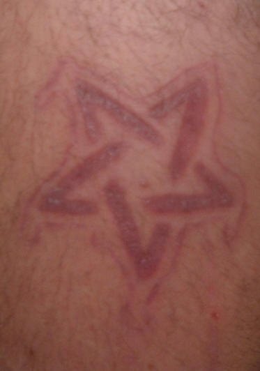 Small Pentagram Scarification Tattoo
