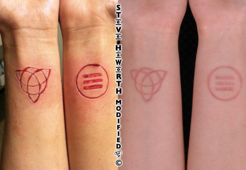 Small Symbols Scarification Before And After Tattoos On Wrists