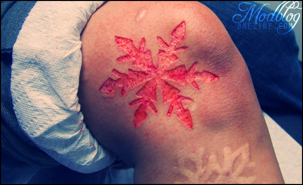 Snowflake Scarification Tattoo